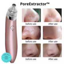 🌿🔧 PoreExtractor™ Extractor De Puntos Negros Y Espinillas ⭐⭐⭐⭐⭐