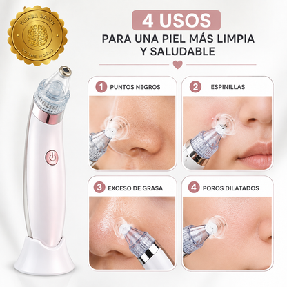 BlackClear™ 🖤✨ Extractor de Puntos Negros y Espinillas ⭐⭐⭐⭐⭐