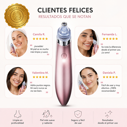 BlackClear™ 🖤✨ Extractor de Puntos Negros y Espinillas ⭐⭐⭐⭐⭐